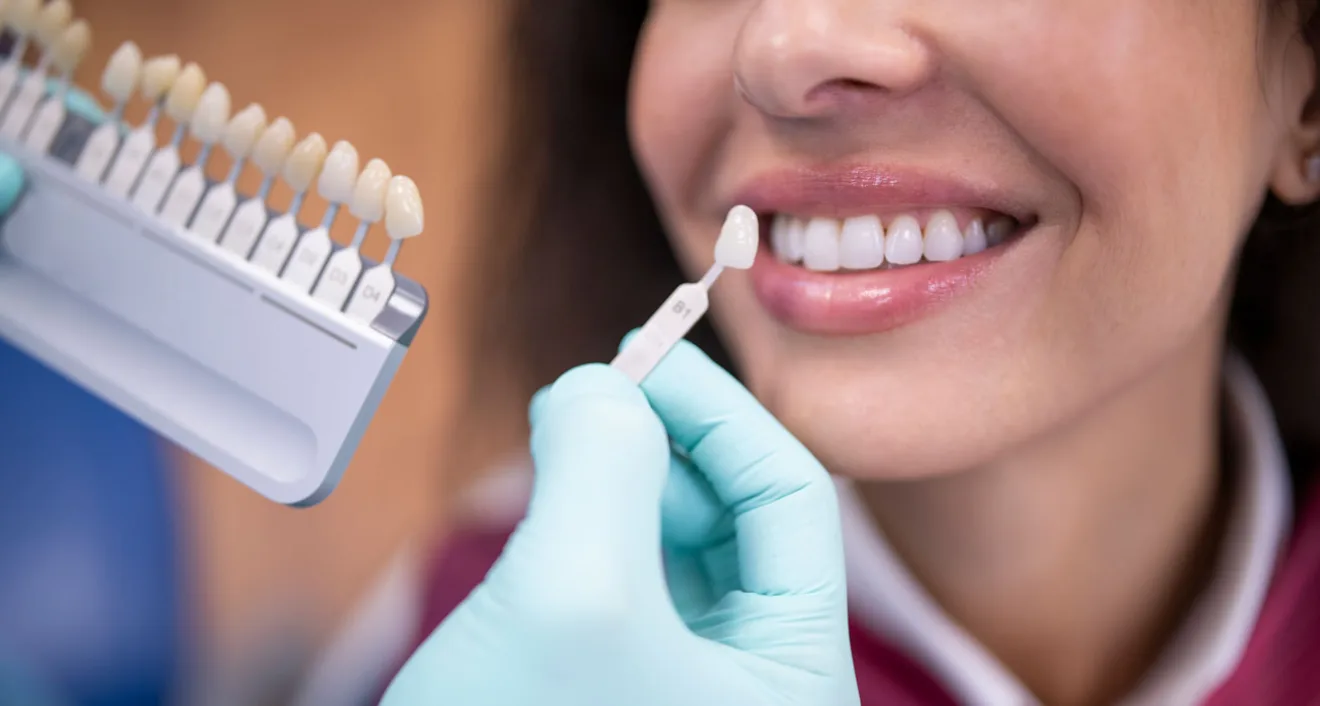 Are Veneers Right For Me? Exploring Benefits, Types, and Your Options Are Veneers Right For Me? Exploring Benefits, Types, and Your Options