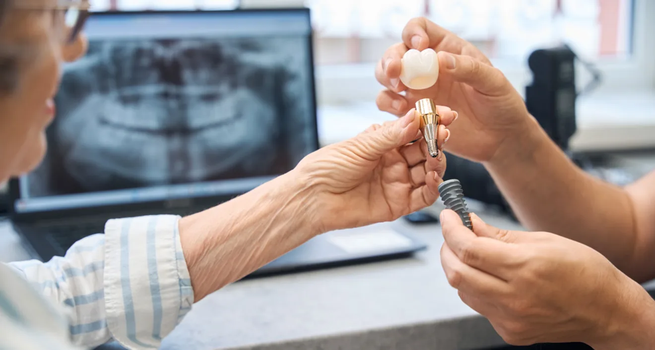 Dental Implants Vs Dentures: Which Is Best For You? Dental Implants Vs Dentures: Which Is Best For You?