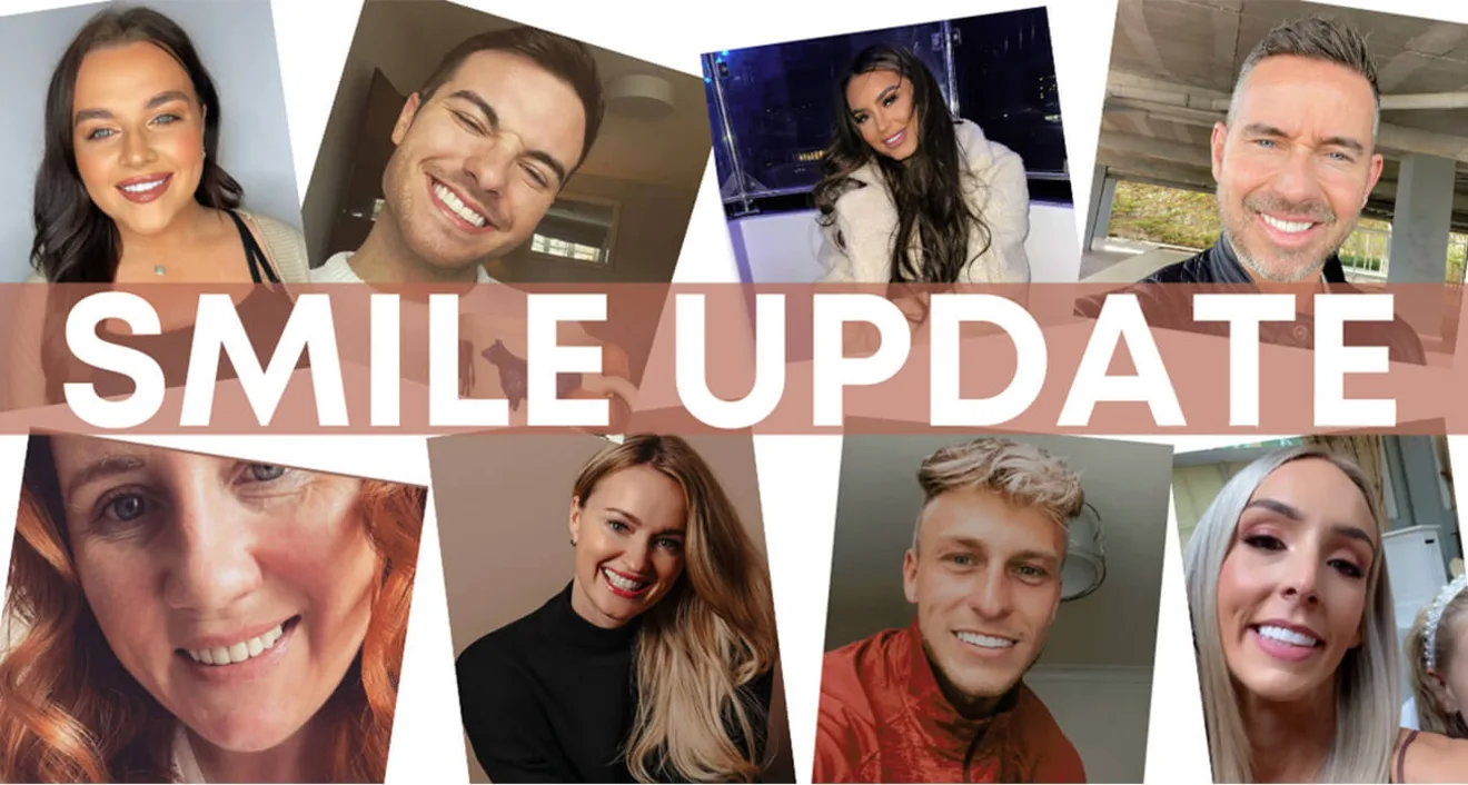 Smile update | September 2021 Smile update | September 2021