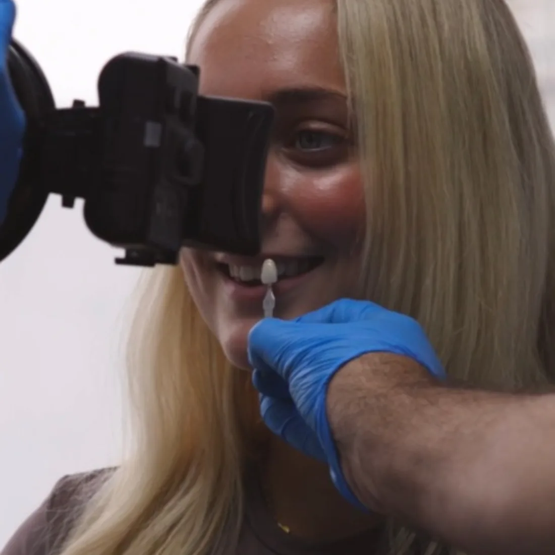 Shade-matching a patient's smile before whitening at Queensway Dental Shade-matching a patient's smile before whitening at Queensway Dental